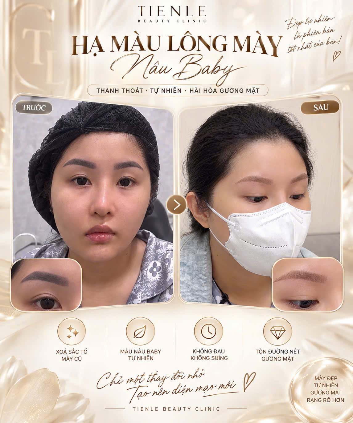 Hạ màu lông mày nâu Baby trước và sau