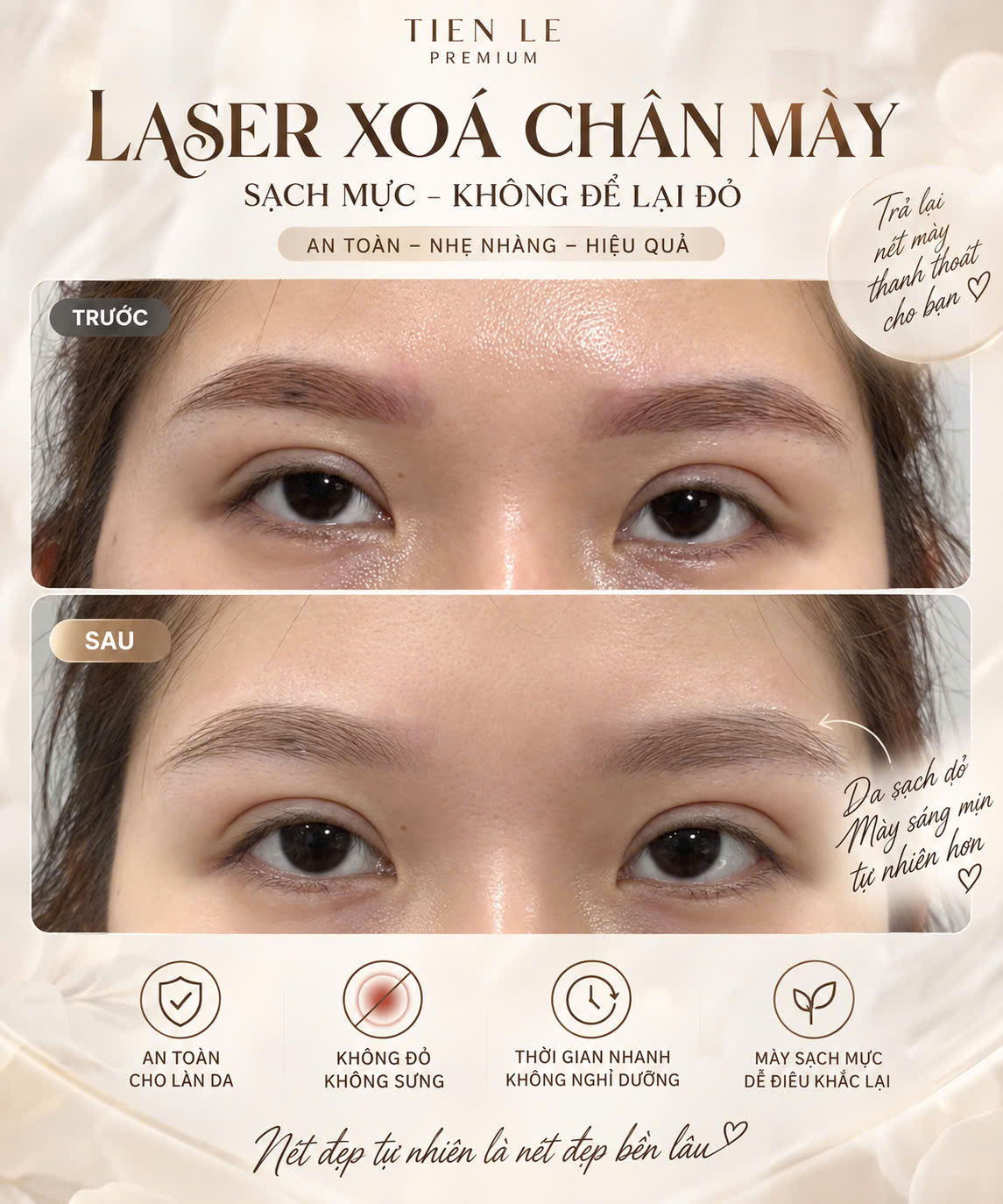Xử lý sửa chân mày hỏng trổ màu quá đậm