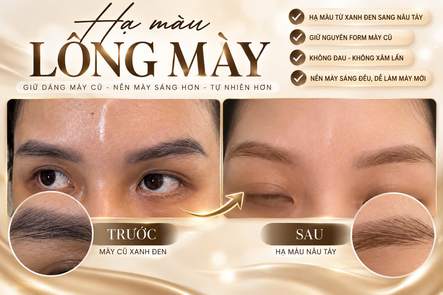 Kết quả hạ màu lông mày thực tế tại Tiên Lê Prenium